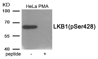 LKB1 (Phospho-Ser428)