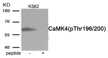 CaMK4 (Phospho-Thr200)