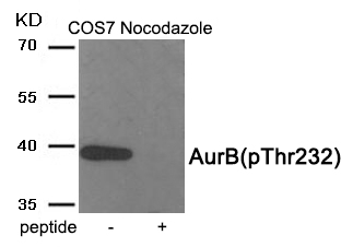 AurB (Phospho-Thr232)