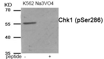 Chk1 (Phospho-Ser286)