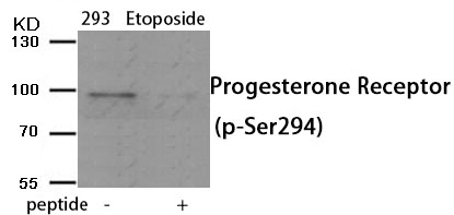 Progesterone Receptor (Phospho-Ser294)