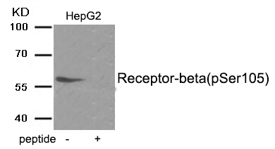 Estrogen Receptor- beta (Phospho-Ser105)