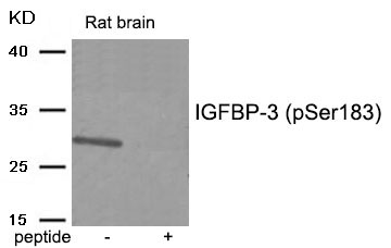 IGFBP-3 (Phospho-Ser183)