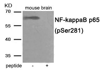 NF- kappaB p65 (Phospho-Ser281)