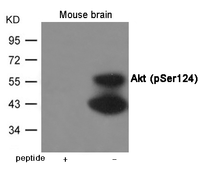 Akt (Phospho-Ser124)