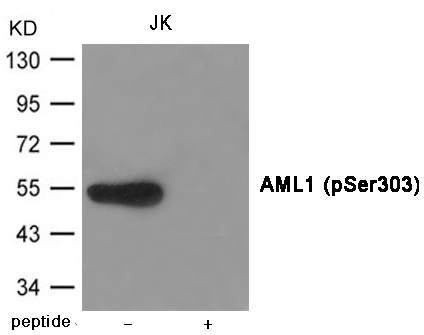 AML1 (Phospho-Ser303)