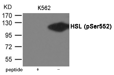 HSL (Phospho-Ser552)