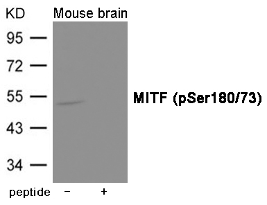 MITF (Phospho-Ser180/73)