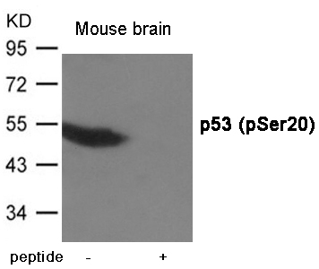 p53 (Phospho-Ser20)