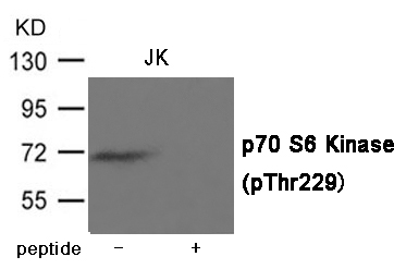 p7S6 Kinase (Phospho-Thr229)