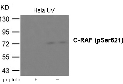 C-RAF (Phospho-Ser621)