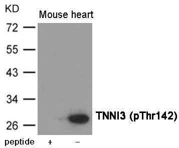 TNNI3 (Phospho-Thr142)