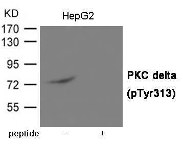 PKC delta (Phospho-Tyr313)