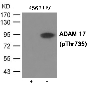 ADAM 17 (Phospho-Thr735)
