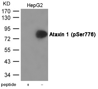 Ataxin 1 (Phospho-Ser776)