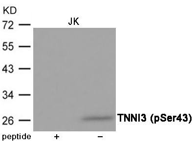 TNNI3 (Phospho-Ser43)