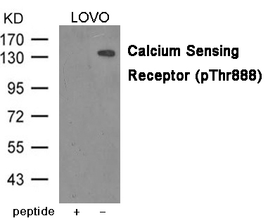 Calcium Sensing Receptor (Phospho-Thr888)