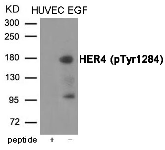 HER4 (Phospho-Tyr1284)