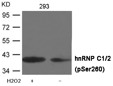 hnRNP C1/2 (Phospho-Ser260)