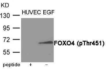 FOXO4 (Phospho-Thr451)