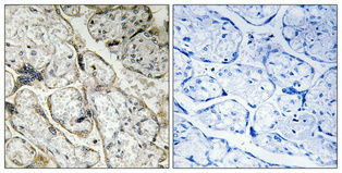 Rabbit Polyclonal Antibody to PI3-kinase p85- alpha (Phospho-Tyr607)