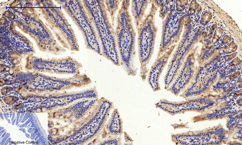 Rabbit Polyclonal Antibody to PI3-kinase p85- alpha (Phospho-Tyr607)