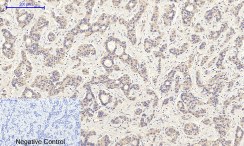 Rabbit Polyclonal Antibody to PI3-kinase p85- alpha (Phospho-Tyr607)