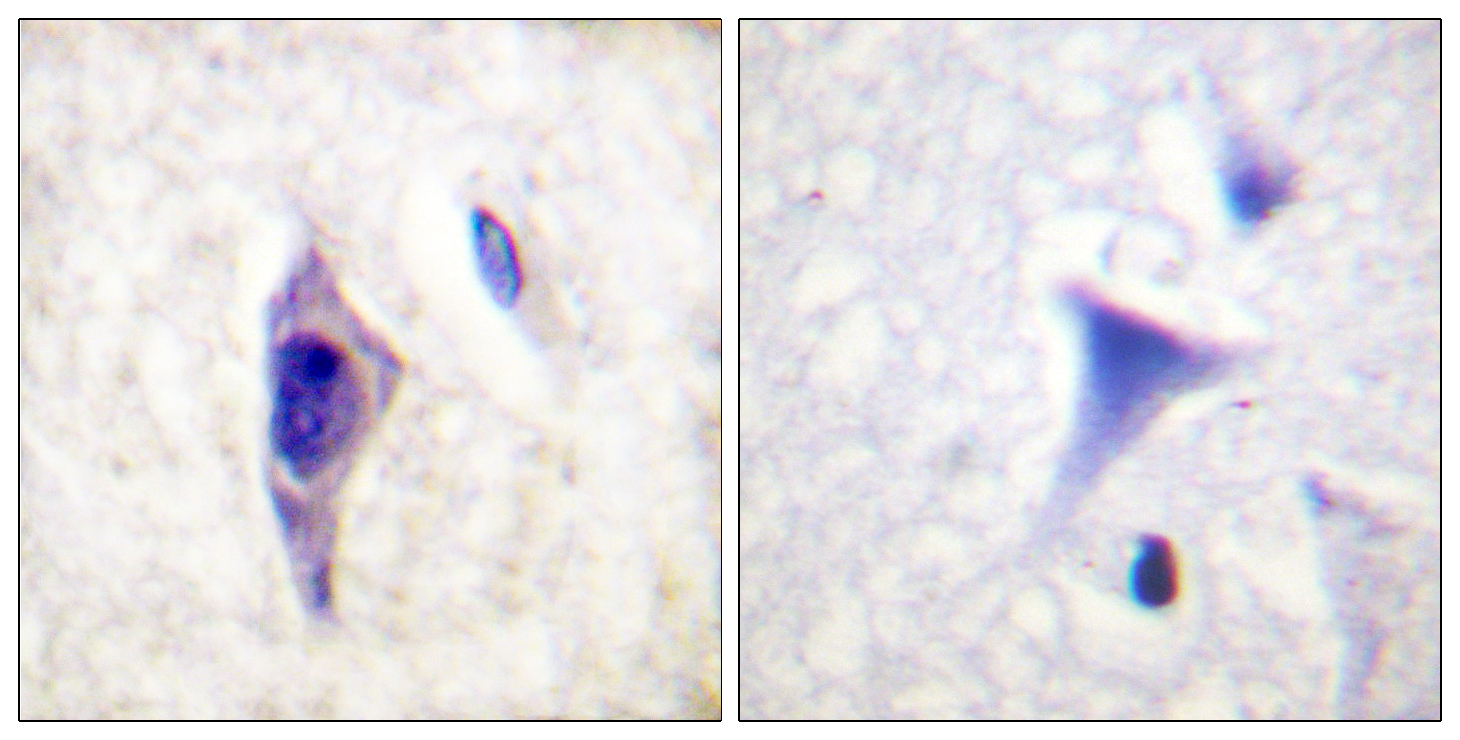 Rabbit Polyclonal Antibody to PI3-kinase p85- alpha (Phospho-Tyr607)