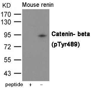 Catenin- beta (Phospho-Tyr489)