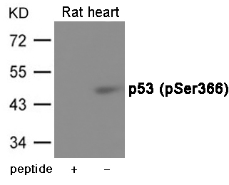 p53 (Phospho-Ser366)