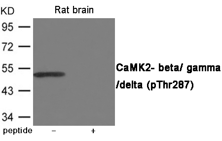 CaMK2- beta/ gamma/ delta (Phospho-Thr287)