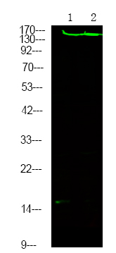 Rabbit Polyclonal Antibody to ROCK2 (Phospho-Tyr722)