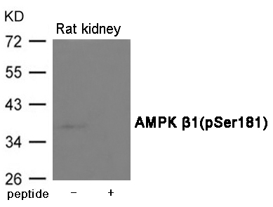 AMPK β1(Phospho-Ser181)