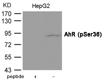 AhR (Phospho-Ser36)