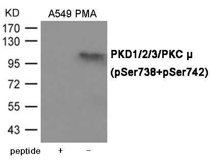 PKD1/2/3/PKC μ (Phospho-Ser738/742)