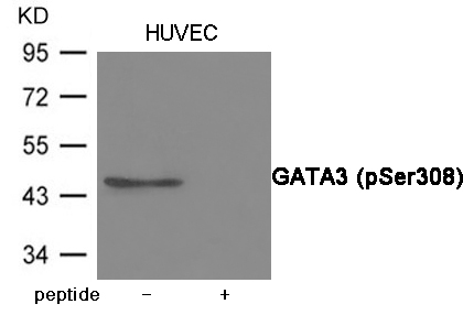 GATA3 (Phospho-Ser308)