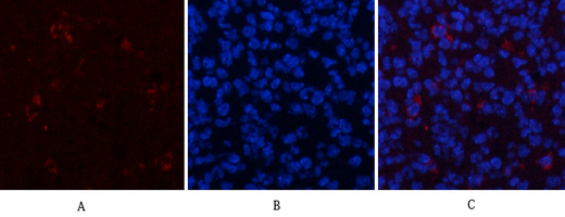 Rabbit Polyclonal Antibody to ERK1/2 (Phospho-Thr202/Tyr204)