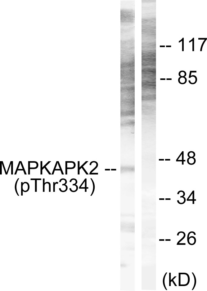 MAPKAPK2 (Phospho-Thr334)