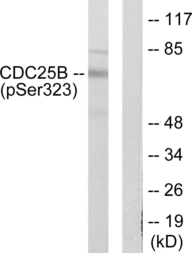 CDC25B (Phospho-Ser323)