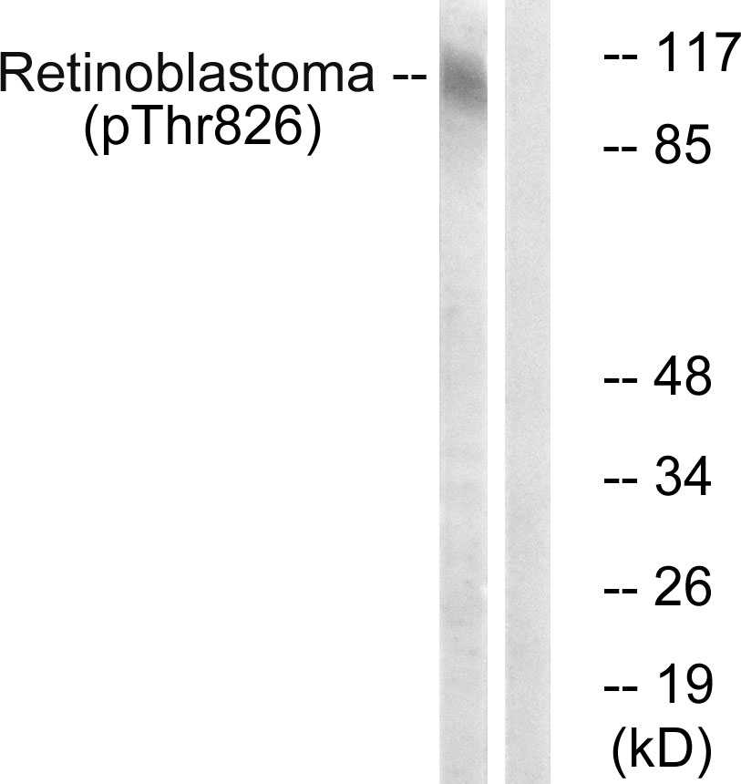 Retinoblastoma (Phospho-Thr826)