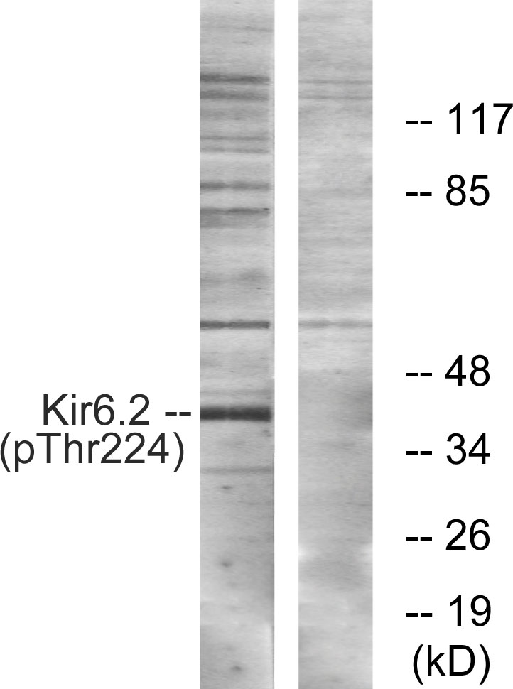 Kir6.2 (Phospho-Thr224)