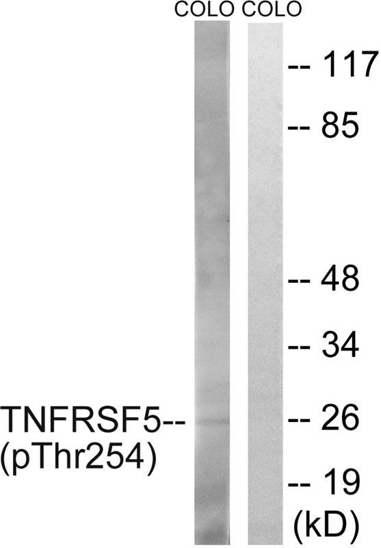 TNFRSF5 (Phospho-Thr254)
