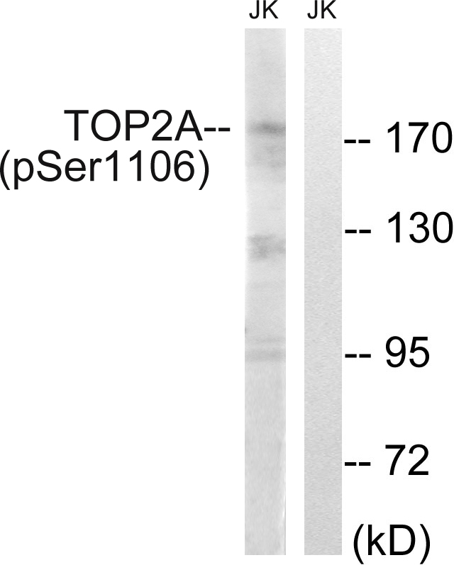 TOP2A (Phospho-Ser1106)