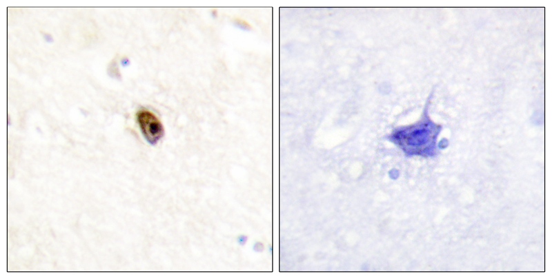 AurB/C (Phospho-Thr236/202)
