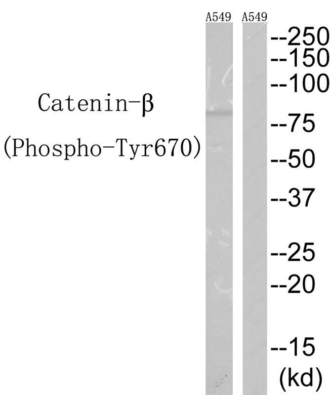 Catenin-β(Phospho-Tyr670)
