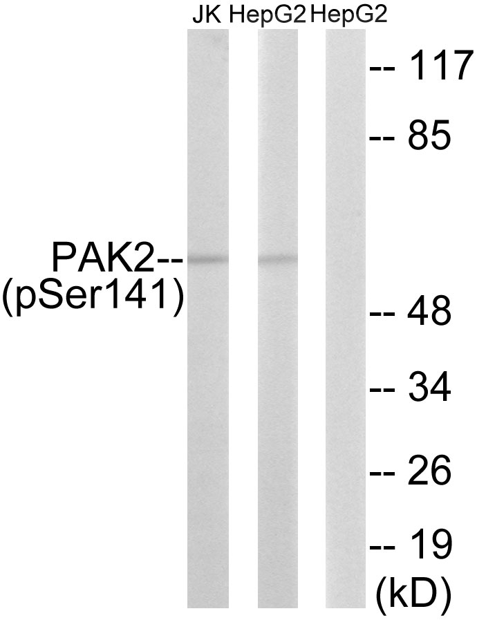 PAK2 (Phospho-Ser141)