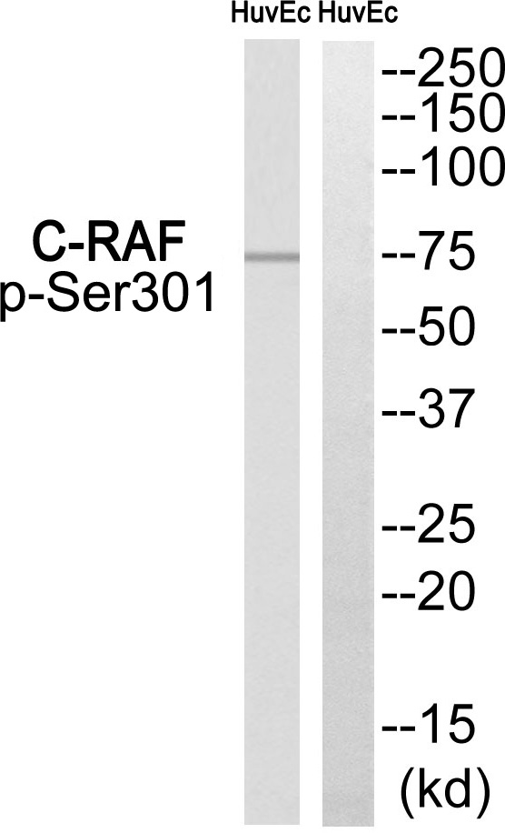 C-RAF (Phospho-Ser301)