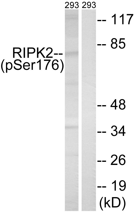 RIPK2 (Phospho-Ser176)