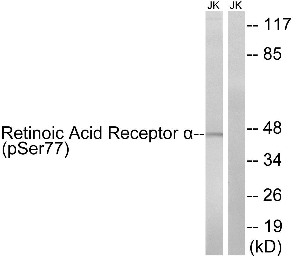 Retinoic Acid Receptor α (Phospho-Ser77)
