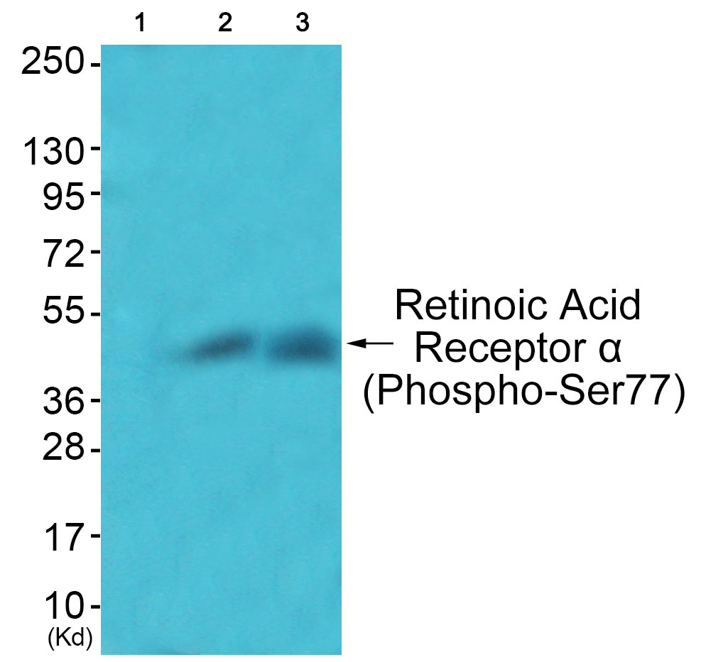 Rabbit Polyclonal Antibody to Retinoic Acid Receptor α (Phospho-Ser77)